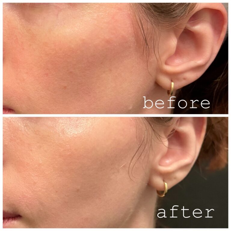 Skinvive Before And After Real Photos