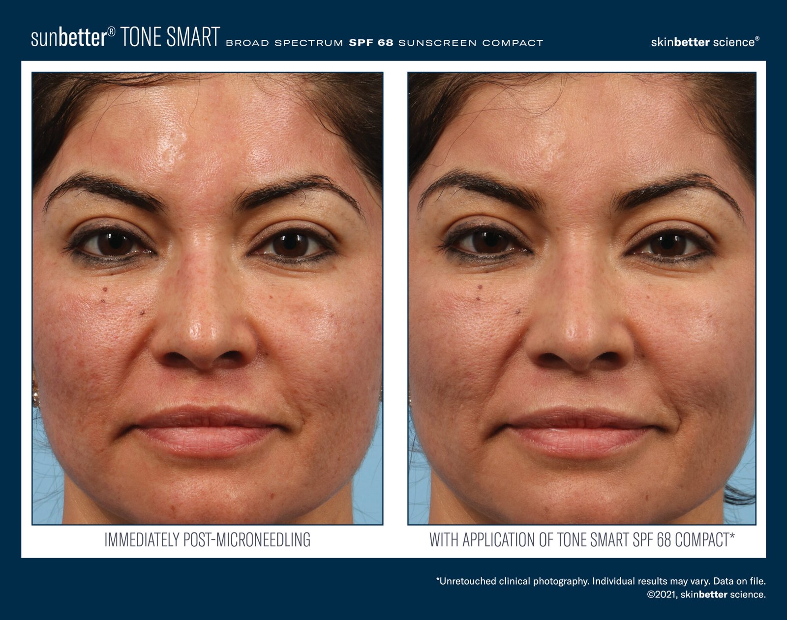 best makeup for microneedling